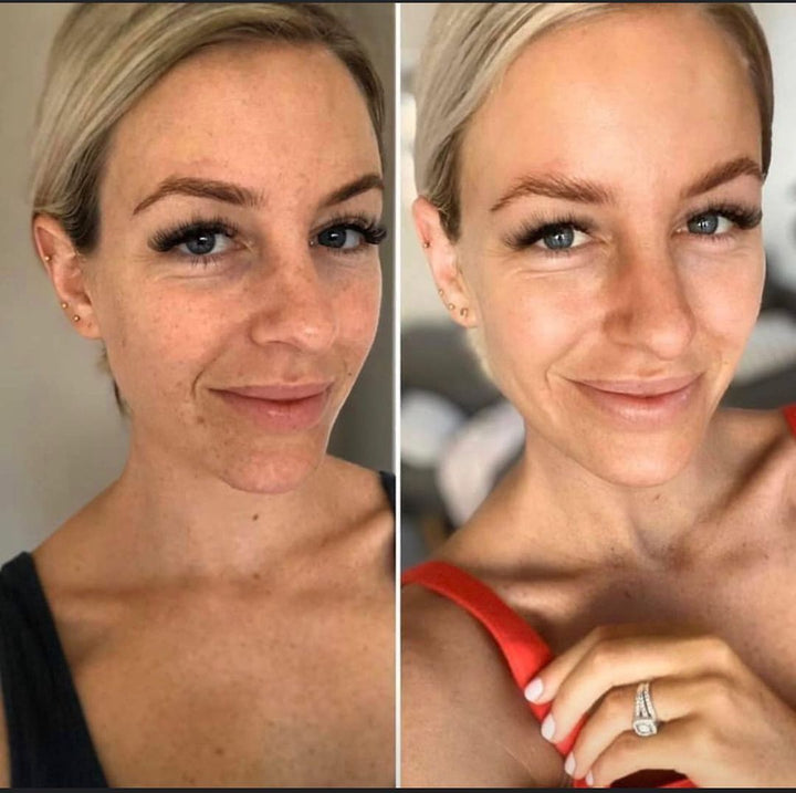 Before and after NIGHT RENEWAL SERUM